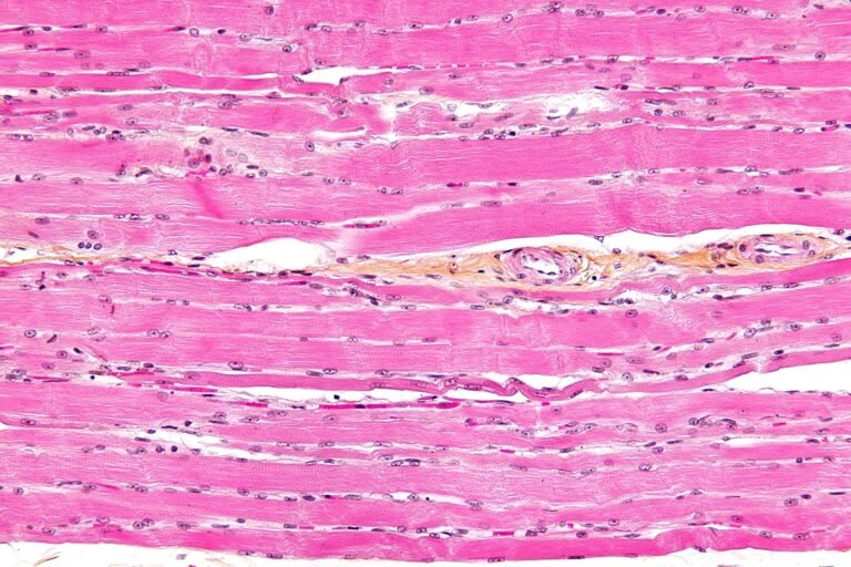 Muscle, Protein and Aging